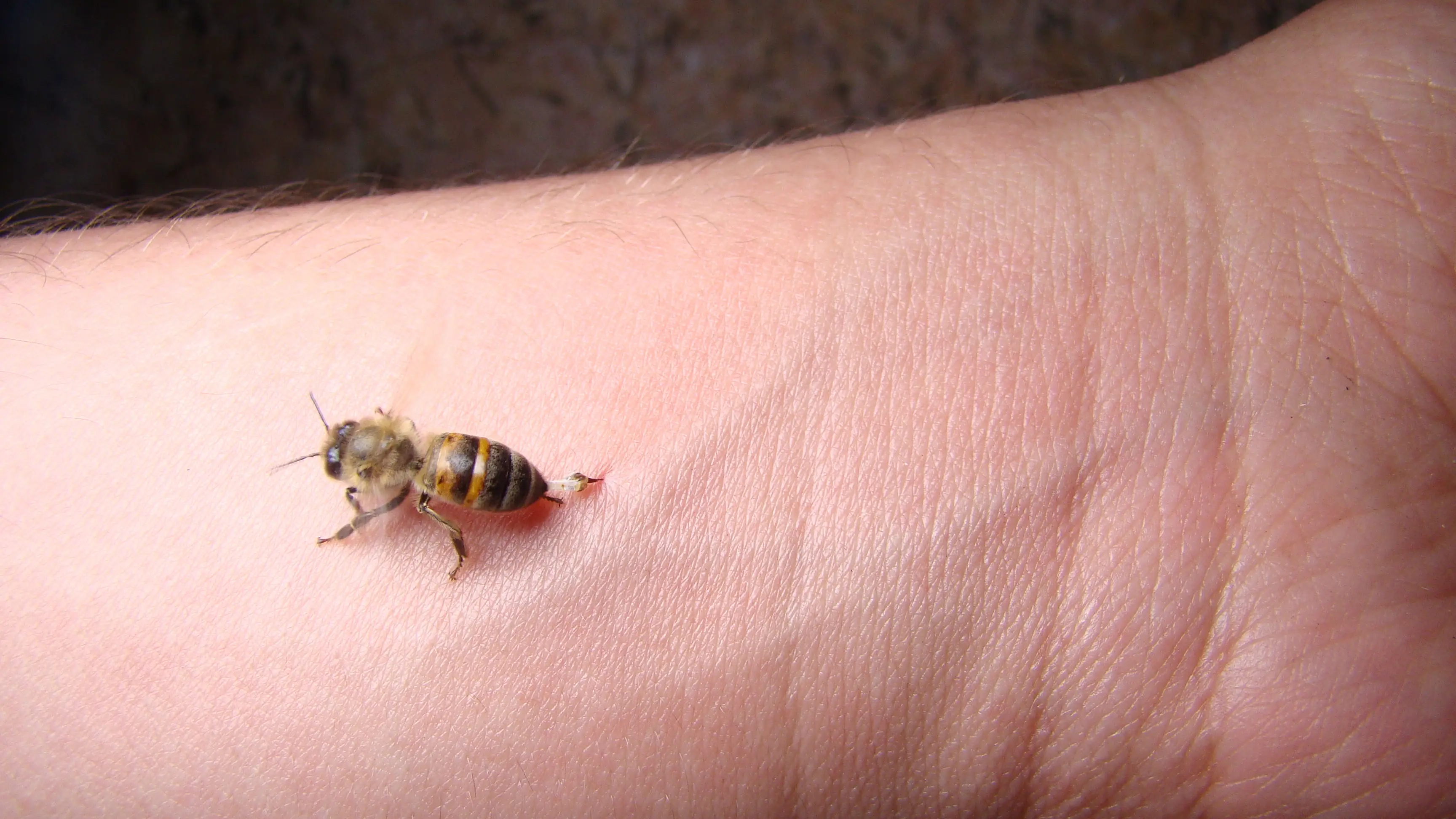 Do Bumble Bees Sting Humans? Stings, Reactions & Treatment